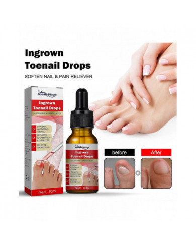 30ml Traitement des ongles incarnés,Traitement de la croissance des ongles,Gouttes d’ongles incarnés Huile pour [...]