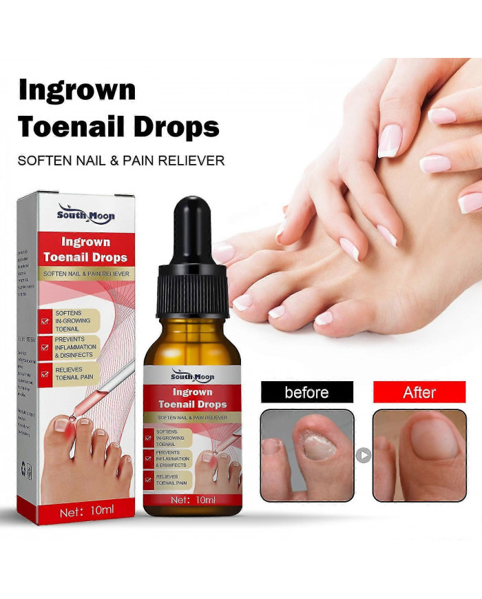 30ml Traitement des ongles incarnés,Traitement de la croissance des ongles,Gouttes d’ongles incarnés Huile pour [...]