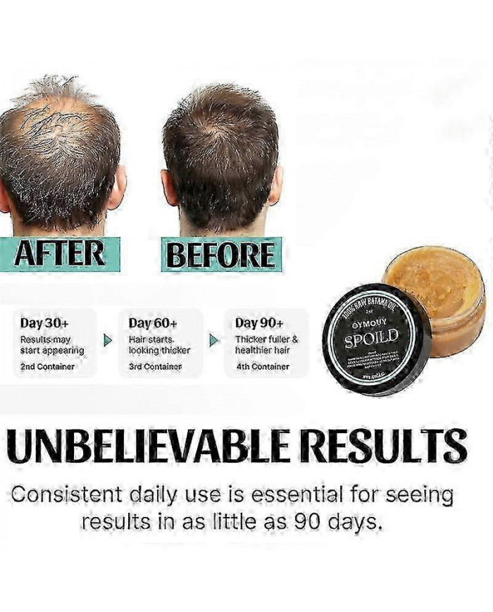 SPOILD 100% Virgin Batana Oil - Huile de Batana brute pour la croissance des cheveux - 100% pure - Renforce [...]