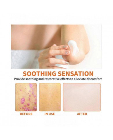 Crème pour psoriasis au venin d’abeille, Crème pour les traitements du psoriasis au venin d’abeille, Crème anti- [...]