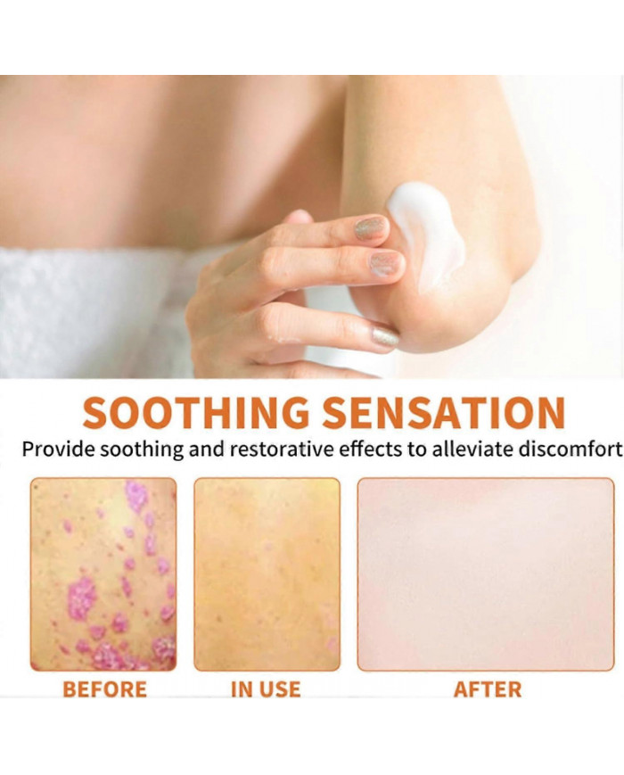 Crème pour psoriasis au venin d’abeille, Crème pour les traitements du psoriasis au venin d’abeille, Crème anti- [...]