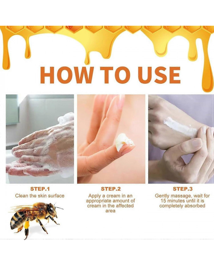Crème pour psoriasis au venin d’abeille, Crème pour les traitements du psoriasis au venin d’abeille, Crème anti- [...]