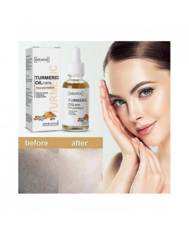 Eelhoe 30ml Huile de Curcuma Pure Naturelle Agréable Hydratante Anti-âge