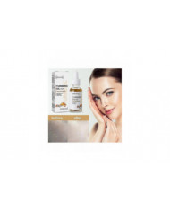 Eelhoe 30ml Huile de Curcuma Pure Naturelle Agréable Hydratante Anti-âge