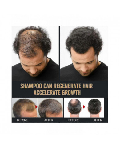 Shampooing activateur de racine, shampooing activateur de racine de crinière, shampooing activateur de racine [...]