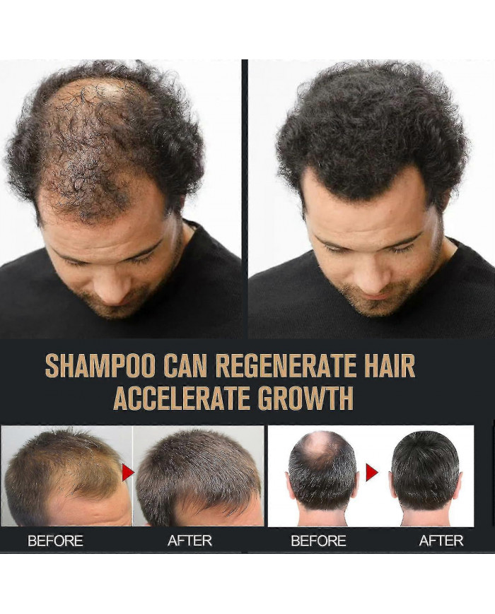 Shampooing activateur de racine, shampooing activateur de racine de crinière, shampooing activateur de racine [...]