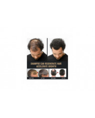 Shampooing activateur de racine, shampooing activateur de racine de crinière, shampooing activateur de racine [...]