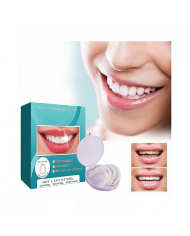 Prothèses dentaires encliquetables réglables, facettes Appareils orthodontiques pour prothèses dentaires Plus [...]