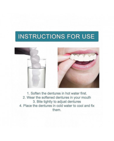 Prothèses dentaires encliquetables réglables, facettes Appareils orthodontiques pour prothèses dentaires Plus [...]