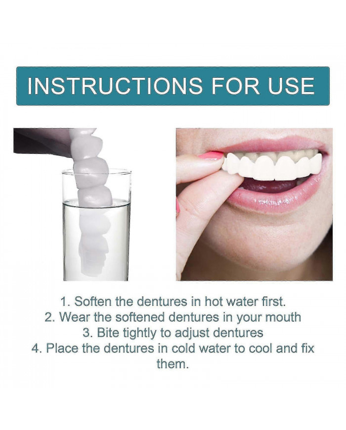 Prothèses dentaires encliquetables réglables, facettes Appareils orthodontiques pour prothèses dentaires Plus [...]