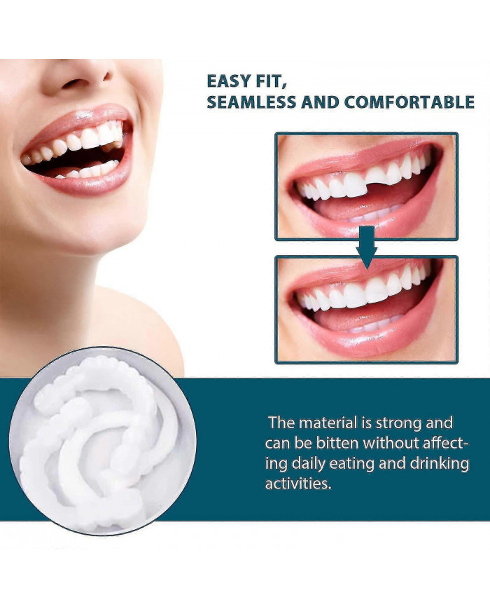 Prothèses dentaires encliquetables réglables, facettes Appareils orthodontiques pour prothèses dentaires Plus [...]