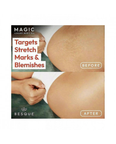 Huile Besque Pour Les Bras, La Poitrine, Les Cuisses Et Les Ventre 100ml/3.52fl Oz