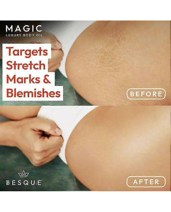 Huile Besque Pour Les Bras, La Poitrine, Les Cuisses Et Les Ventre 100ml/3.52fl Oz