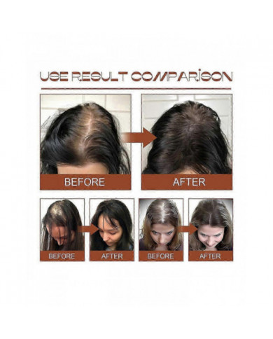 2x Huile de Batana pour la croissance des cheveux Pour des cheveux plus épais et plus sains, crème de soin des cheveux