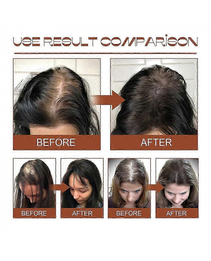 2x Huile de Batana pour la croissance des cheveux Pour des cheveux plus épais et plus sains, crème de soin des cheveux