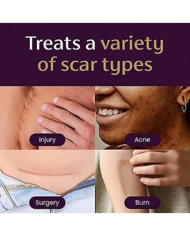 Mederma Pm Crème de nuit intensive pour cicatrices 1,0 oz (28g)