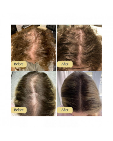 Huile de croissance des cheveux naturelle végétalienne, Huile de croissance des cheveux végétalienne, Huile [...]