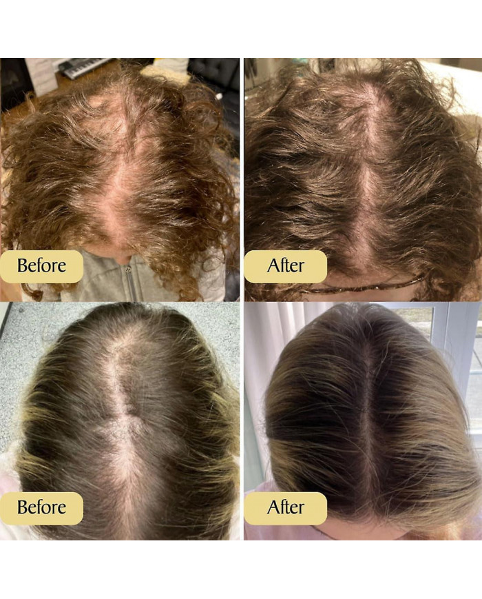 Huile de croissance des cheveux naturelle végétalienne, Huile de croissance des cheveux végétalienne, Huile [...]