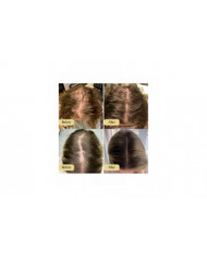 Huile de croissance des cheveux naturelle végétalienne, Huile de croissance des cheveux végétalienne, Huile [...]