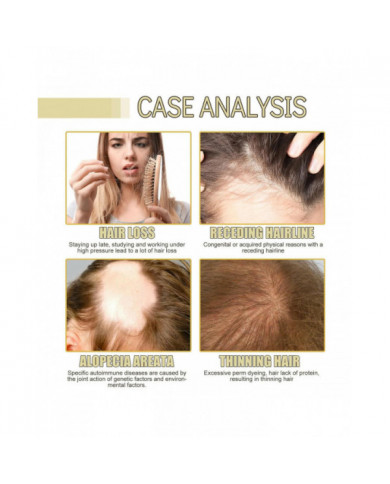 Huile de croissance des cheveux naturelle végétalienne, Huile de croissance des cheveux végétalienne, Huile [...]