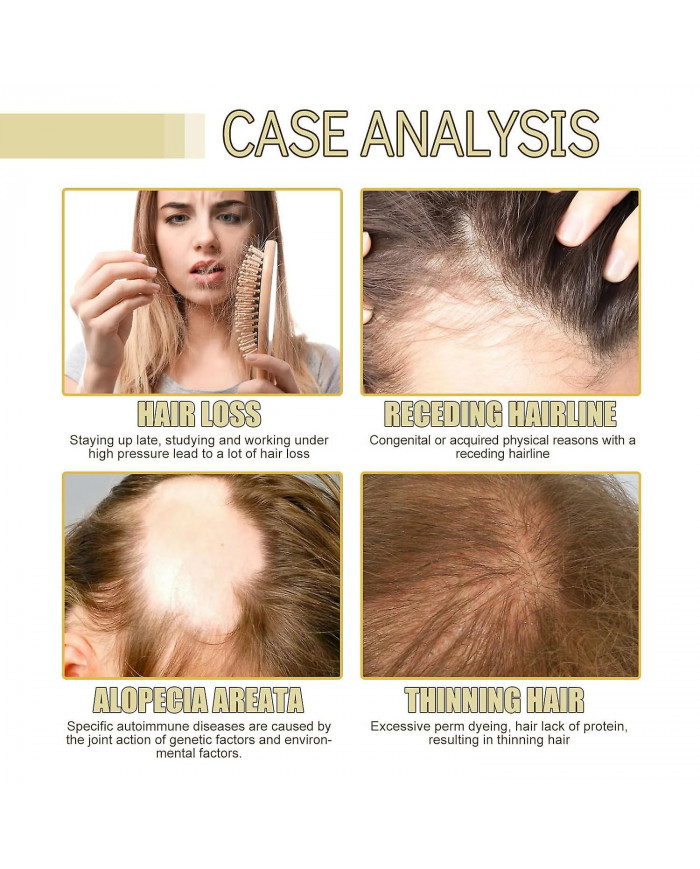 Huile de croissance des cheveux naturelle végétalienne, Huile de croissance des cheveux végétalienne, Huile [...]