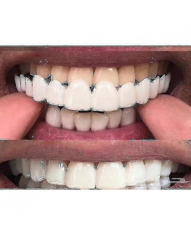 Accolades de prothèses dentaires de blanchiment Comfort Fit Flex supérieure/inférieure