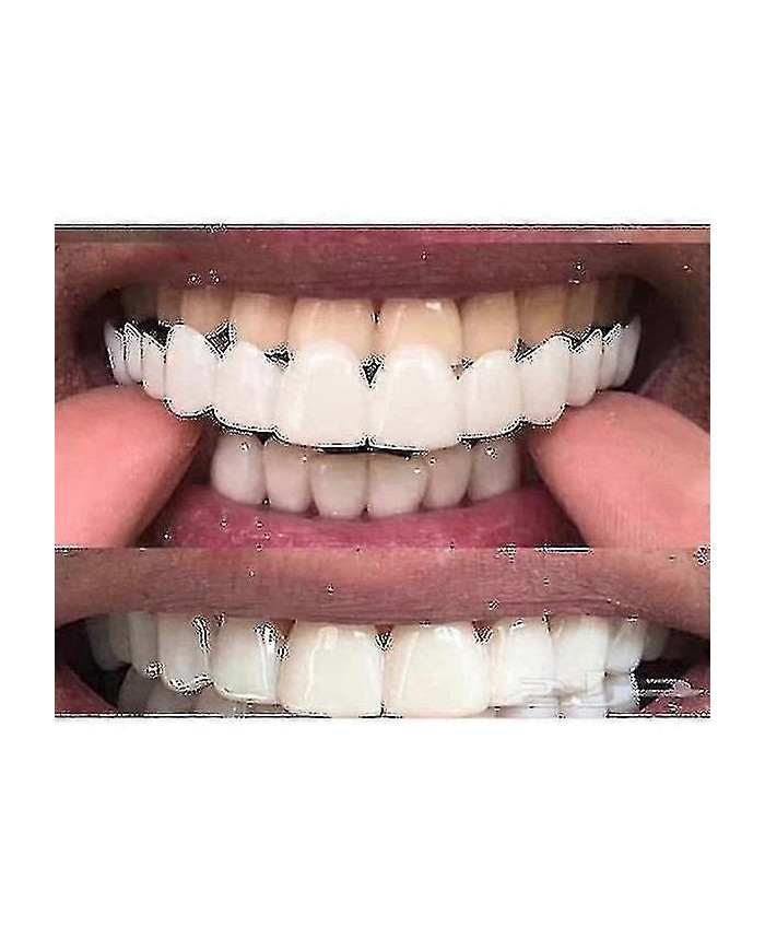 Accolades de prothèses dentaires de blanchiment Comfort Fit Flex supérieure/inférieure