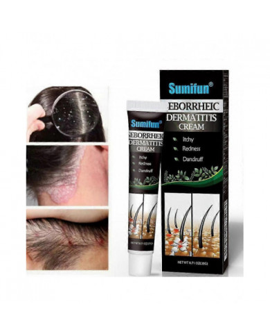Traitement De La Dermatite Séborrhéique Psoriasique Crème Tête Acné Prurit Cuir Chevelu Teigne Réparation Crème [...]