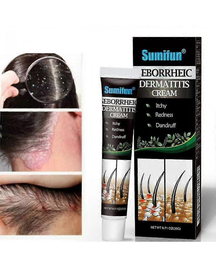 Traitement De La Dermatite Séborrhéique Psoriasique Crème Tête Acné Prurit Cuir Chevelu Teigne Réparation Crème [...]