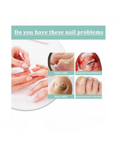 1/3/5 Pcs Stylo De Soins Des Ongles Stylo Ongle Champignon Traitement Ongle Infection Fongique