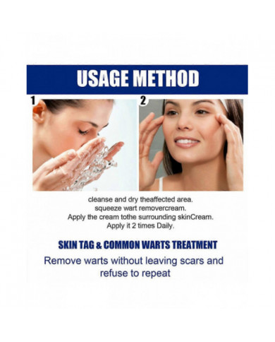 20g Verrues Onguents Nettoyants Anti-taches Chair Naevus Crème Décolorante pour Usage Externe