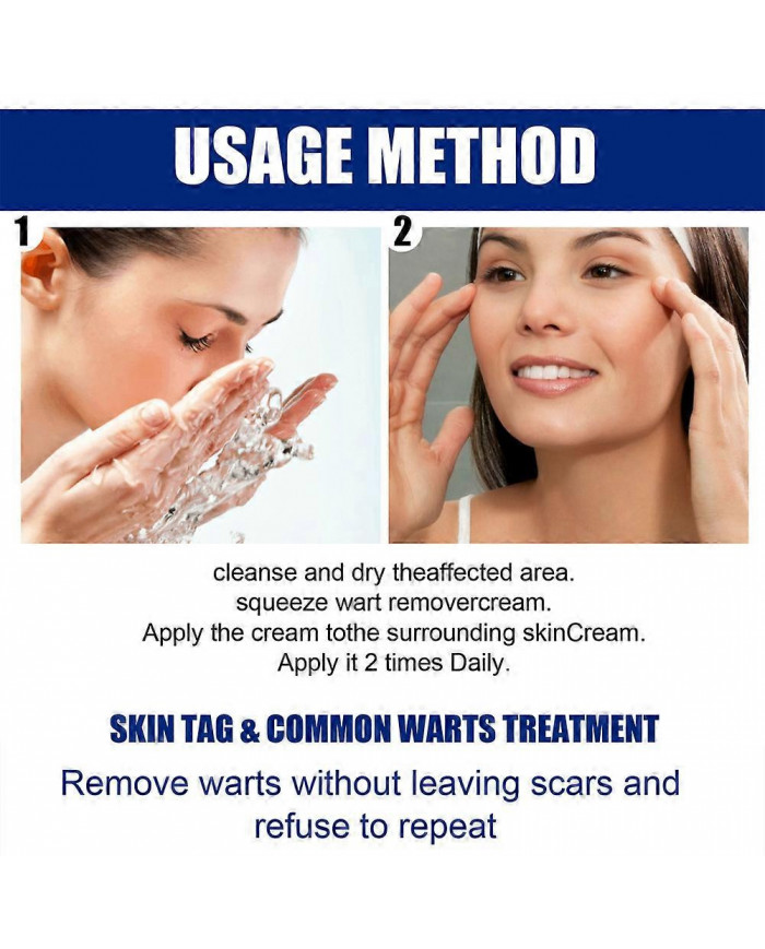 20g Verrues Onguents Nettoyants Anti-taches Chair Naevus Crème Décolorante pour Usage Externe