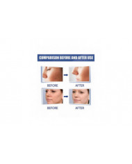 20g Verrues Onguents Nettoyants Anti-taches Chair Naevus Crème Décolorante pour Usage Externe