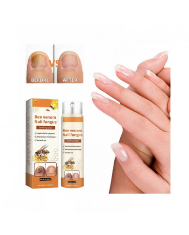 Sérum réparateur d’ongles au venin d’abeille, Solution de soin des ongles, Spray de soin des ongles au venin [...]