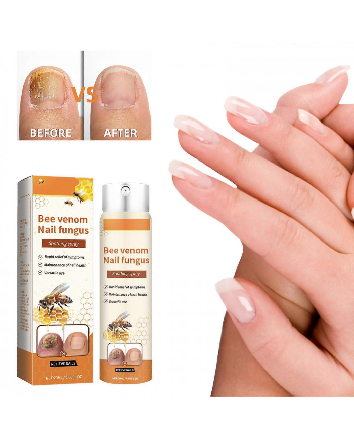 Sérum réparateur d’ongles au venin d’abeille, Solution de soin des ongles, Spray de soin des ongles au venin [...]