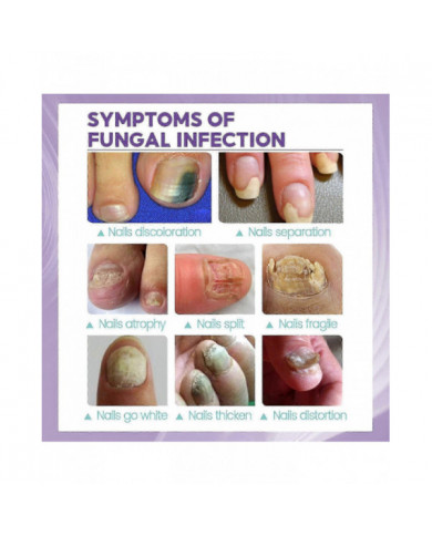 2pcs Medinail Fungus Spray Nouveau