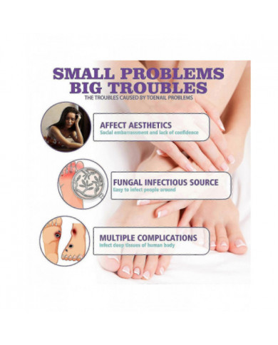 2pcs Medinail Fungus Spray Nouveau