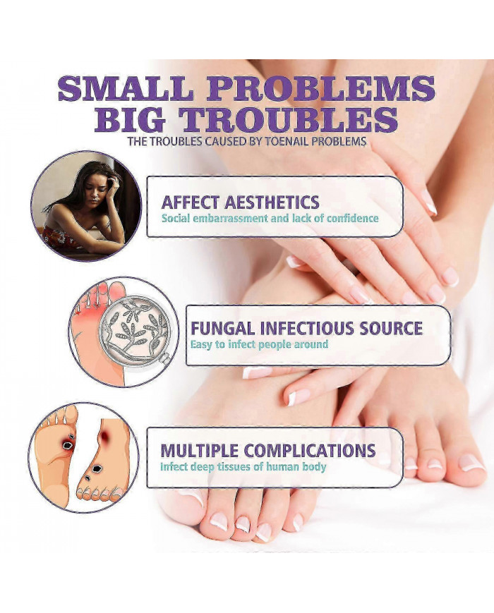 2pcs Medinail Fungus Spray Nouveau