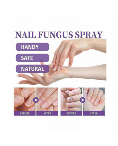 2pcs Medinail Fungus Spray Nouveau