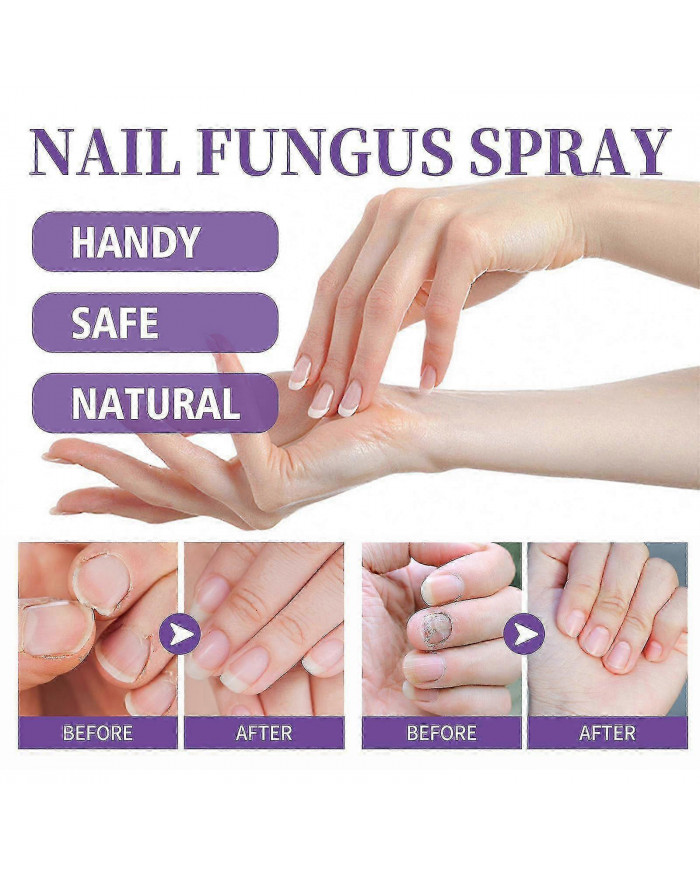 2pcs Medinail Fungus Spray Nouveau