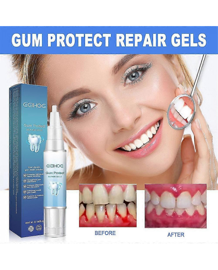 3pcs Gencive Réparation Gel Reconstruire Renforcer Blanchir Enlever L’inflammation de l’haleine Dent Buccale [...]