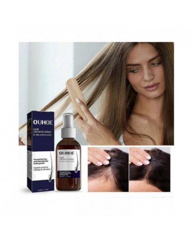 Spray pour la croissance des cheveux pour prévenir la perte de cheveux