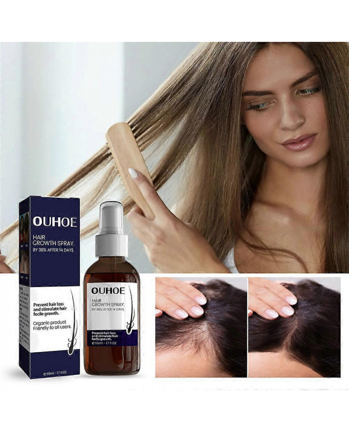 Spray pour la croissance des cheveux pour prévenir la perte de cheveux
