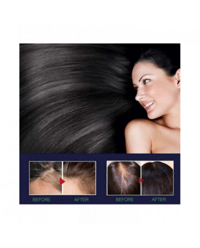 Spray pour la croissance des cheveux pour prévenir la perte de cheveux