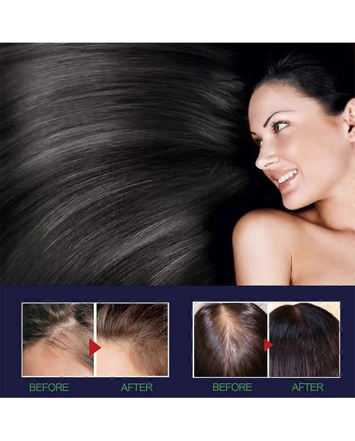 Spray pour la croissance des cheveux pour prévenir la perte de cheveux