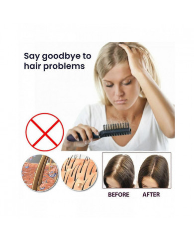 Spray pour la croissance des cheveux pour prévenir la perte de cheveux