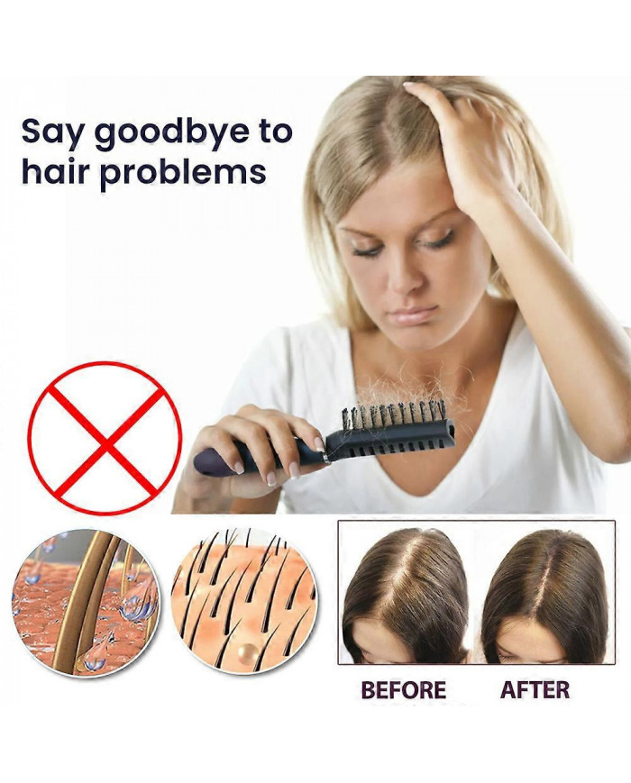 Spray pour la croissance des cheveux pour prévenir la perte de cheveux