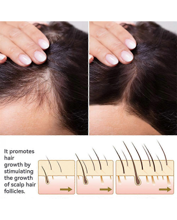 Spray pour la croissance des cheveux pour prévenir la perte de cheveux