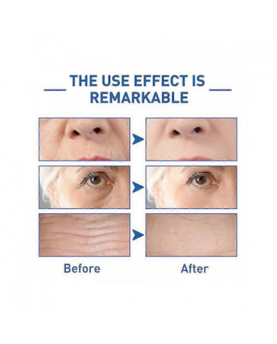 1-3pcs Anti-âge Hyalu B5 Sérum Anti-rides Concentré Réparateur 30ml