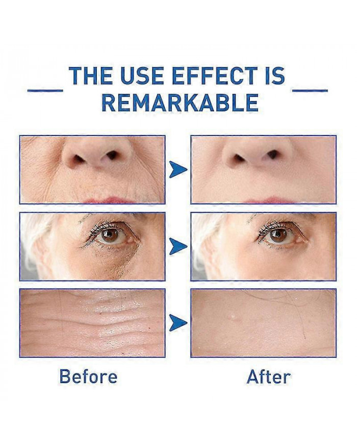 1-3pcs Anti-âge Hyalu B5 Sérum Anti-rides Concentré Réparateur 30ml